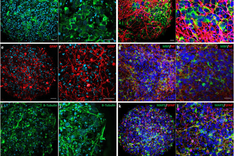 Rotenone exerts developmental neurotoxicity in a human brain spheroid model Featured Image