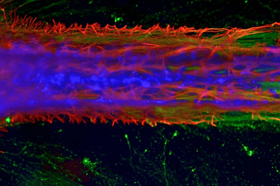 Modeling chemotherapy-induced peripheral neuropathy using a nerve-on-a-chip microphysiological system Featured Image