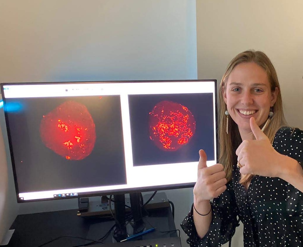 Megan Terral poses with IHC results